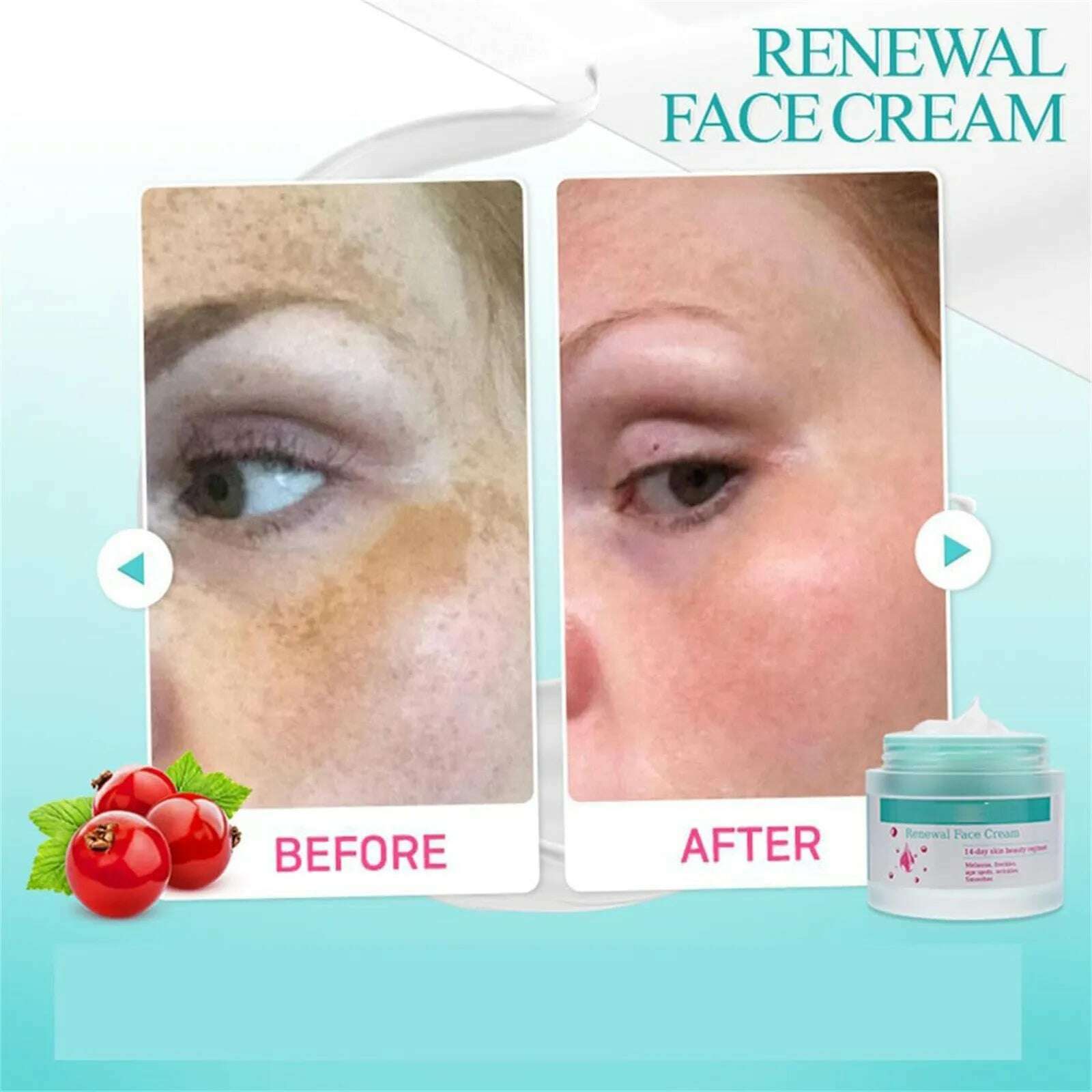 2024 New Cream For Melasma, Nourishing And Moisturizing Skin Face Cream Anti-Wrinkle Reduces Dark Spots And Fine Lines - KIMLUD