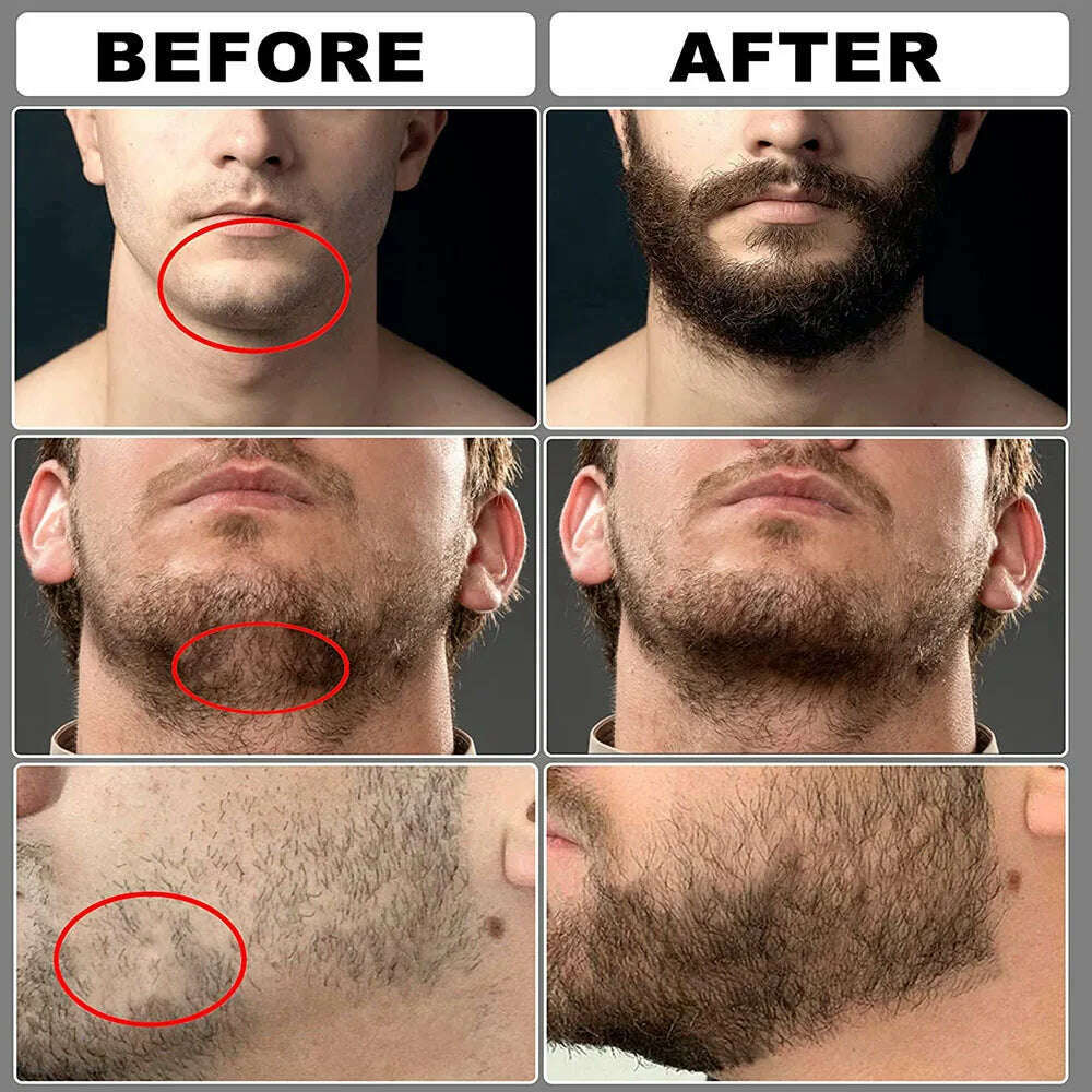 KIMLUD, 5pcs/set Beard Growth Kit For Men Hair Enhancer Thicker Mustache Grooming Beard Care Oil Moisturizer Wax Balm With Roller Comb, KIMLUD Womens Clothes