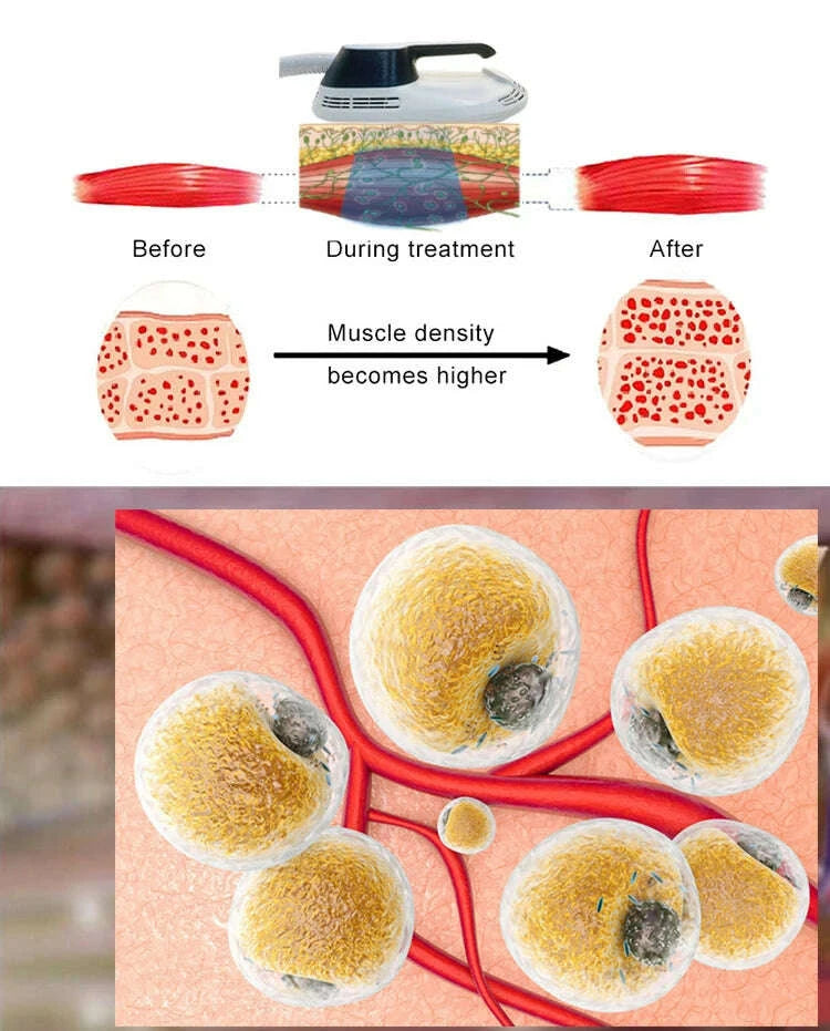 kimlud-hot-selling-professional-high-frequency-shaping-body-whole-body-muscle-lifting-tightening-beauty-medical-machine-kimlud-womens-clothes-35044860