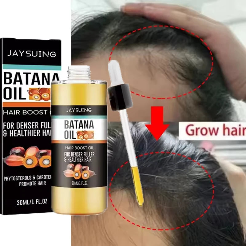 Batana Oil Hair Growth Set Traction Alopecia Treatment Anti-Hair Loss — Golden Amber | KIMLUD