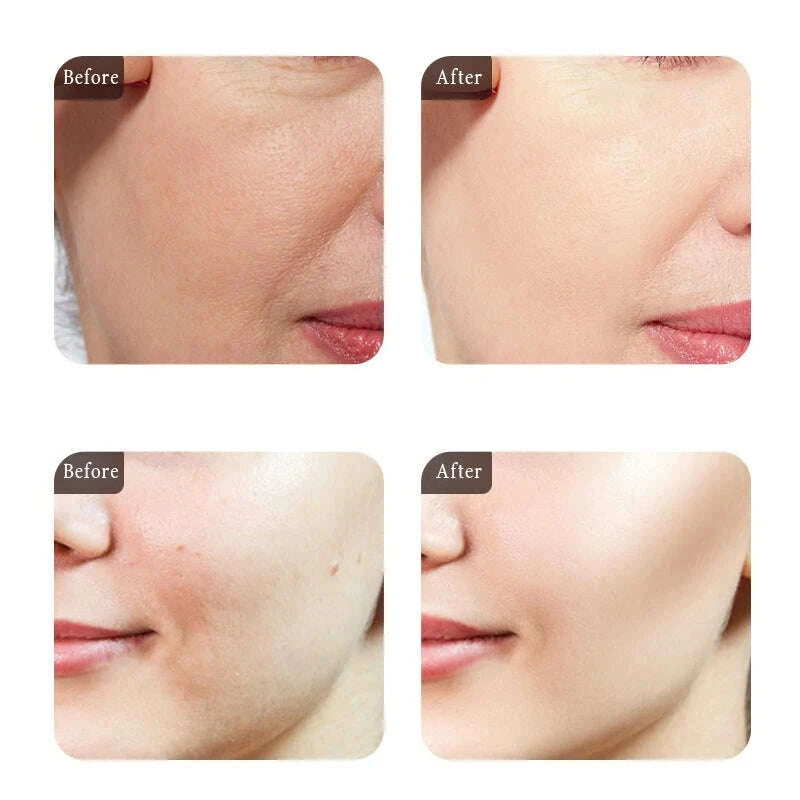 moisturizing-face-serum-and-cream-brighten-firming-anti-wrinkle-collagen-pre-essence-caviar-eye-cream-dark-circle-eyebag-removerkimludkimlud-35560086