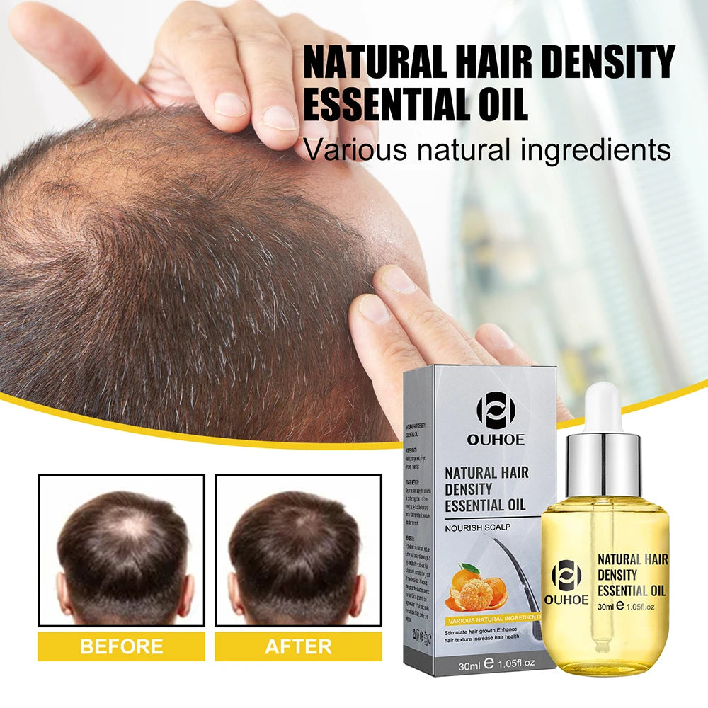 Ginger-Infused Hair Growth Oil Gift Set Ginger Essence — Golden | KIMLUD