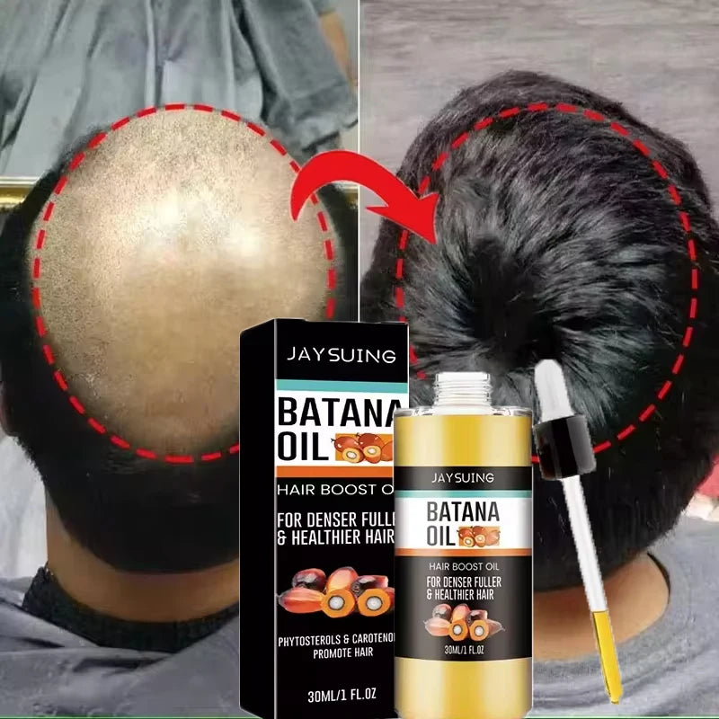 Batana Oil Hair Growth Set Traction Alopecia Treatment Anti-Hair Loss — Golden Amber | KIMLUD