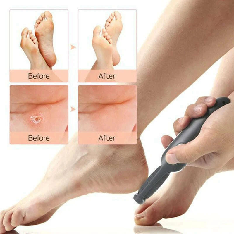 rechargeable-callus-remover-tool-home-foot-spa-bath-massager-pedicure-experience-removes-dry-skin-for-smoother-feetkimlud-womens-fashion-34599372