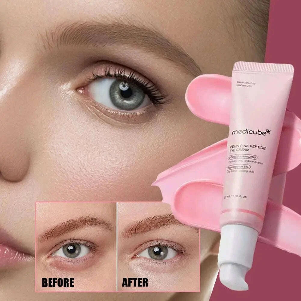 pink-peptide-eye-cream-nano-retinol-brightening-firming-30ml-tightening-firming-fine-line-improve-dark-circles-eyes-puffykimludkimlud-35563571