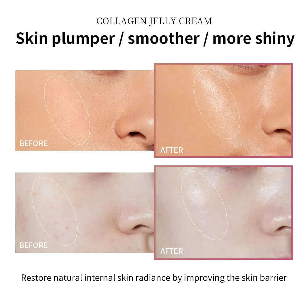 100ml-collagen-jelly-cream-niacinamide-tightening-soothing-moisturizing-anti-aging-firmness-hydration-skincare-100ml-face-gelkimlud-womens-fashion-34601107