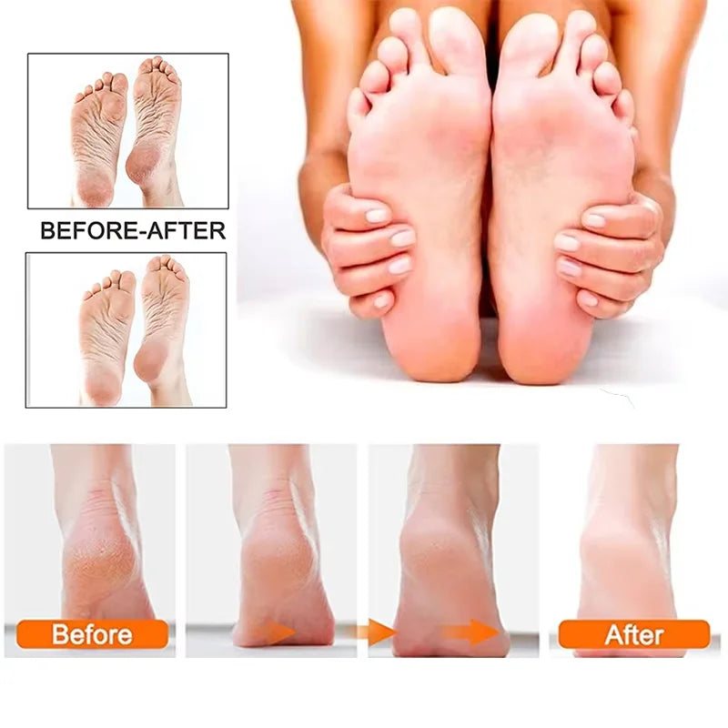 Professional Electric Foot Callus Remover Rechargeable Electronic Foot File Pedicure Tool Kit Foot Care for Dead Skin