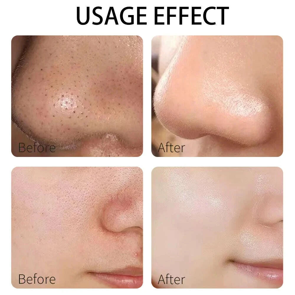 a-variety-of-clay-masks-green-tea-turmeric-dead-sea-mud-whitening-and-hydrating-deep-cleansing-of-pores-oil-control-and-mokimludkimlud-35568277