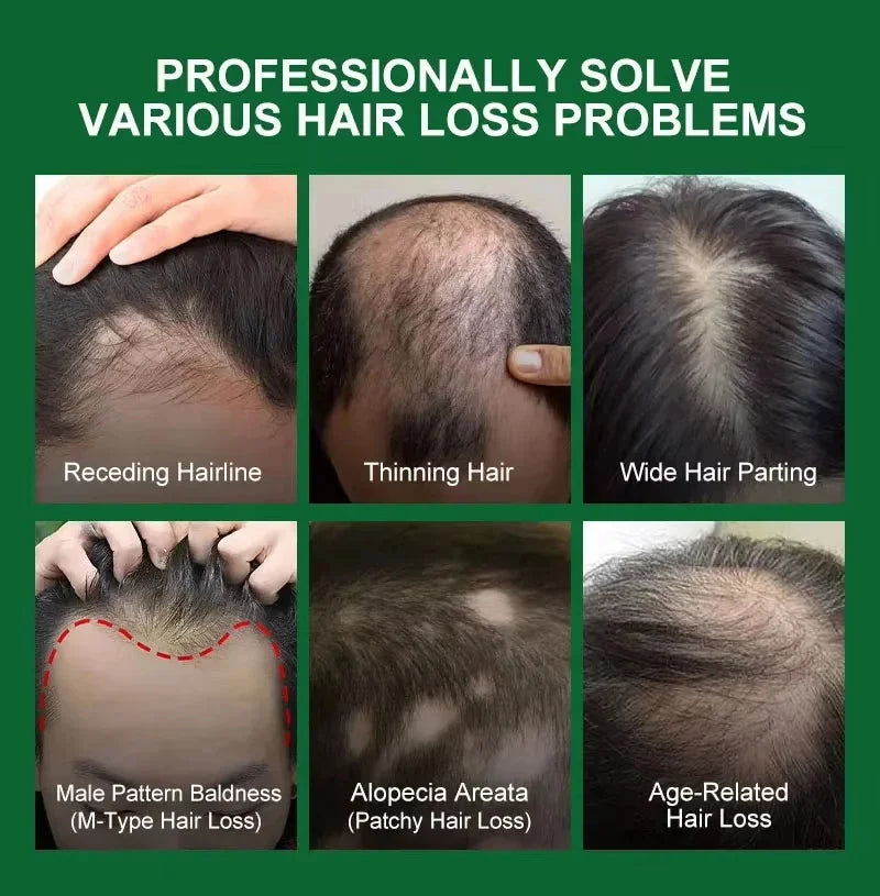 Hair Growth Serum 7 Days Fast Regrowth Essential Capsule Anti Hair loss Baldness Repair Damaged Scalp Treatment For Women Men