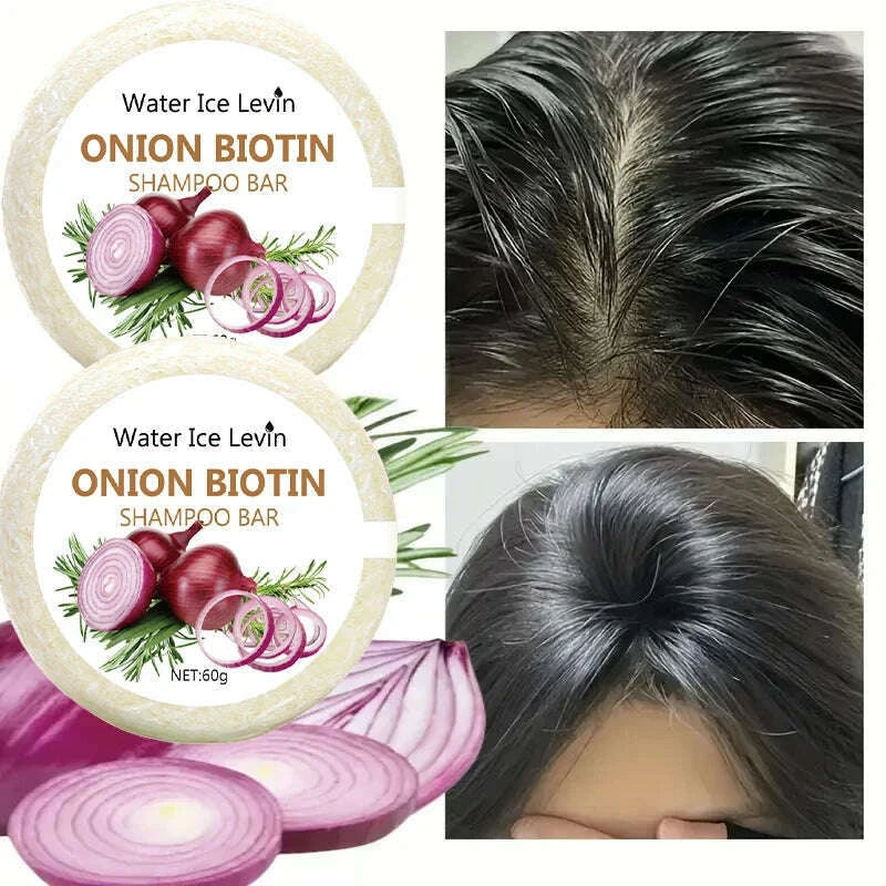 onion-and-biotin-shampoo-soap---60g-suitable-for-all-hair-types-moisturizing-and-smoothing-rich-in-rosemary-extractkimlud-womens-fashion-34609379