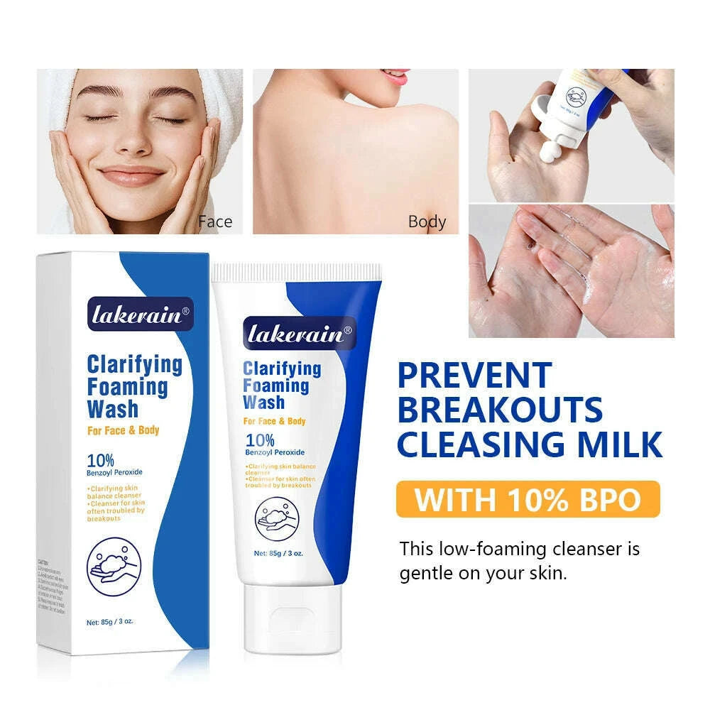 acne-foaming-wash-benzoyl-peroxide-10-maximum-antimicrobia-oil-control-reduces-redness-deep-cleaning-for-face-body-skincarekimlud-womens-fashion-34601157