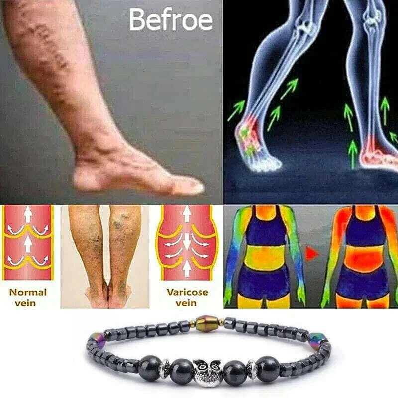 molded-slimming-magnetic-therapy-health-magnet-ankle-chains-relieve-fatigue-weight-loss-magnet-anklets-natural-stones-braceletskimlud-womens-fashion-34620171