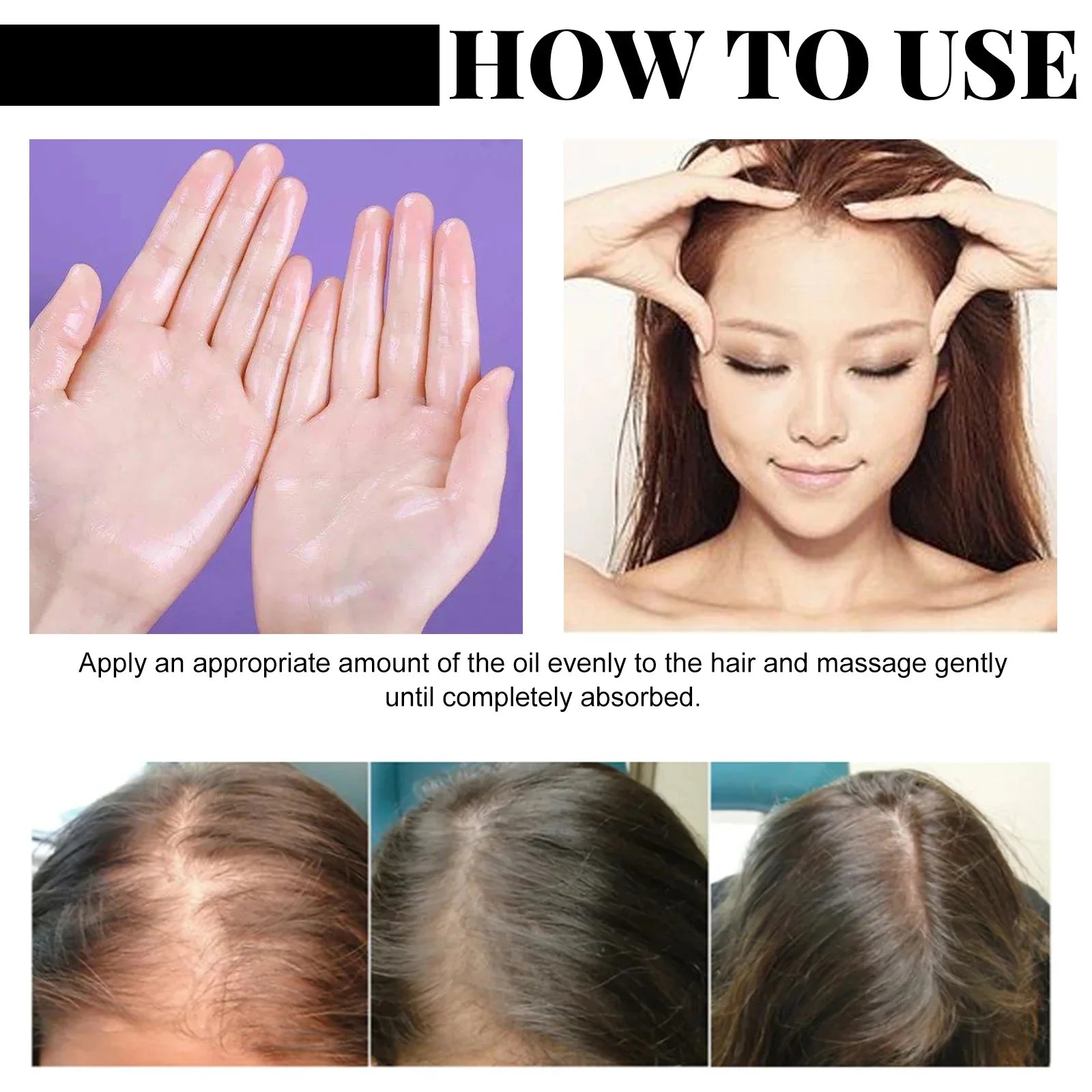 Batana Oil Hair Growth Set Traction Alopecia Treatment Anti-Hair Loss — Golden Amber | KIMLUD
