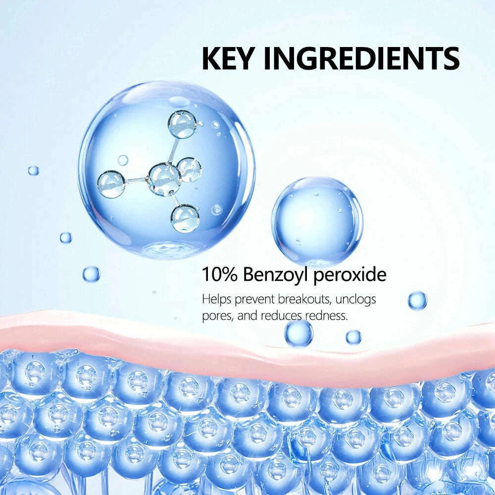acne-foaming-wash-benzoyl-peroxide-10-maximum-antimicrobia-oil-control-reduces-redness-deep-cleaning-for-face-body-skincarekimlud-womens-fashion-34601156