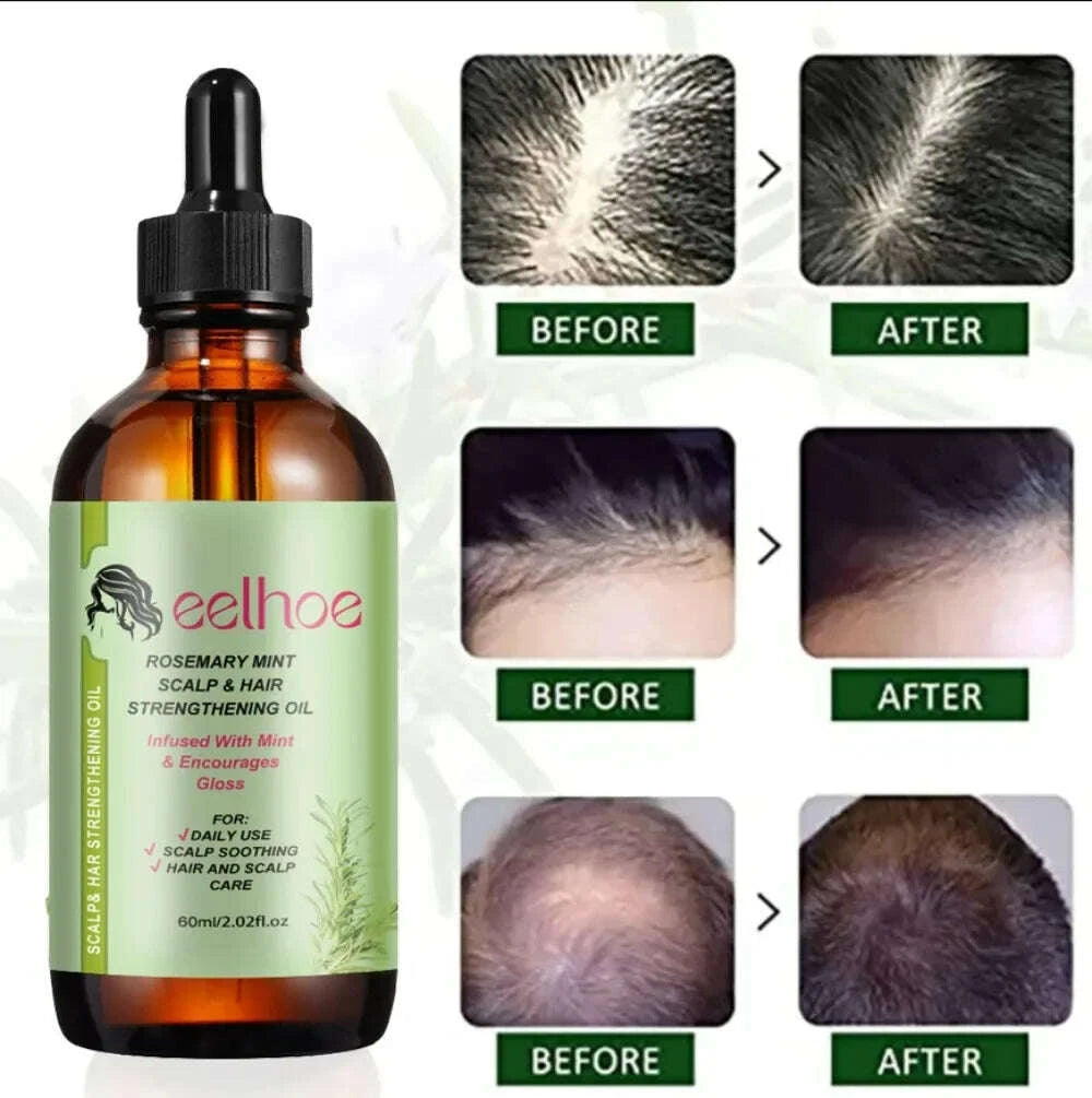 hair-growth-essential-oil-rosemary-mint-hair-strengthening-oil-nourishing-treatment-for-ends-and-dry-organics-hairkimludkimlud-35565418