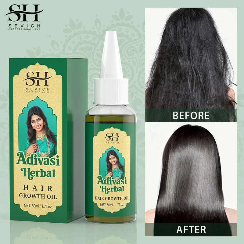 ayurvedic-hair-growth-oil-india-adivasi-organic-hair-growth-serum-anti-hair-loss-fast-regrowth-thicken-oils-hair-growth-productskimludkimlud-35565237