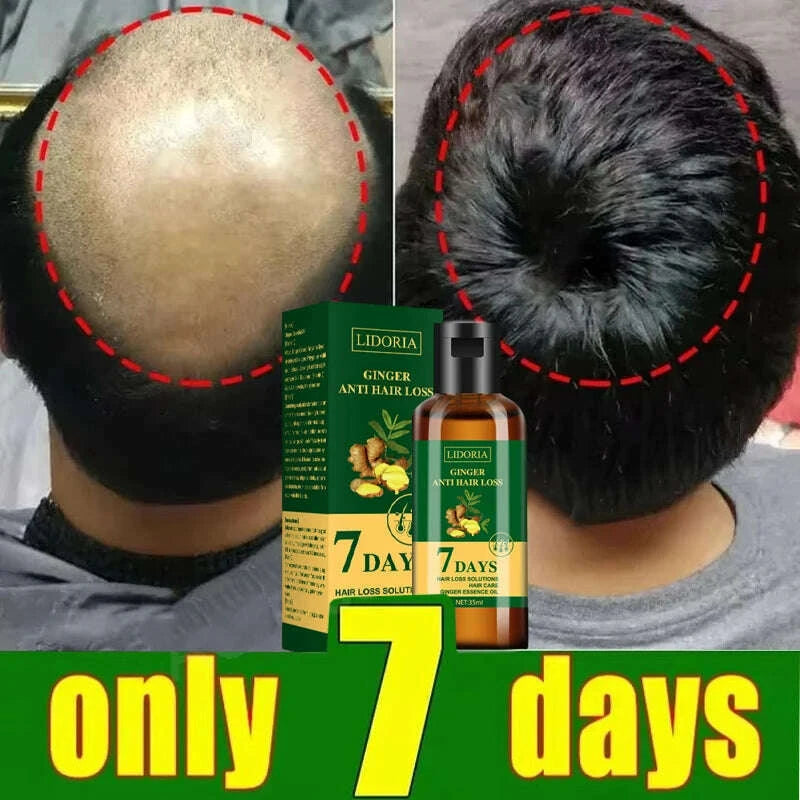 hair-growth-serum-7-days-fast-regrowth-essential-capsule-anti-hair-loss-baldness-repair-damaged-scalp-treatment-for-women-menkimlud-womens-fashion-34619626