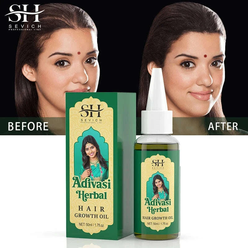 ayurvedic-hair-growth-oil-india-adivasi-organic-hair-growth-serum-anti-hair-loss-fast-regrowth-thicken-oils-hair-growth-productskimludkimlud-35565242