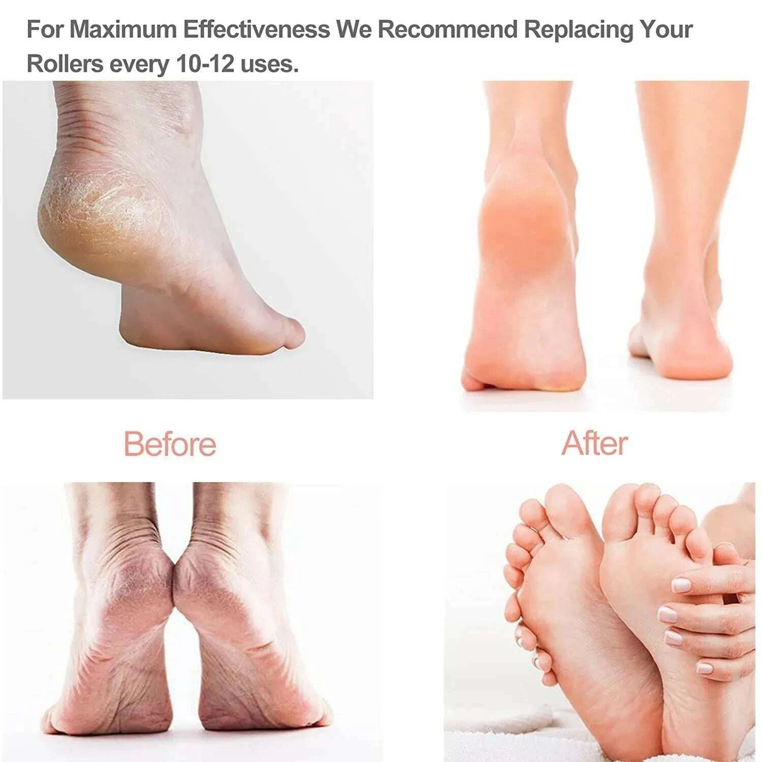 rechargeable-electric-foot-file-callus-remover-pedicure-machine-apparatus-for-heels-grinding-device-foot-corns-remove-rollerkimlud-womens-fashion-34599451