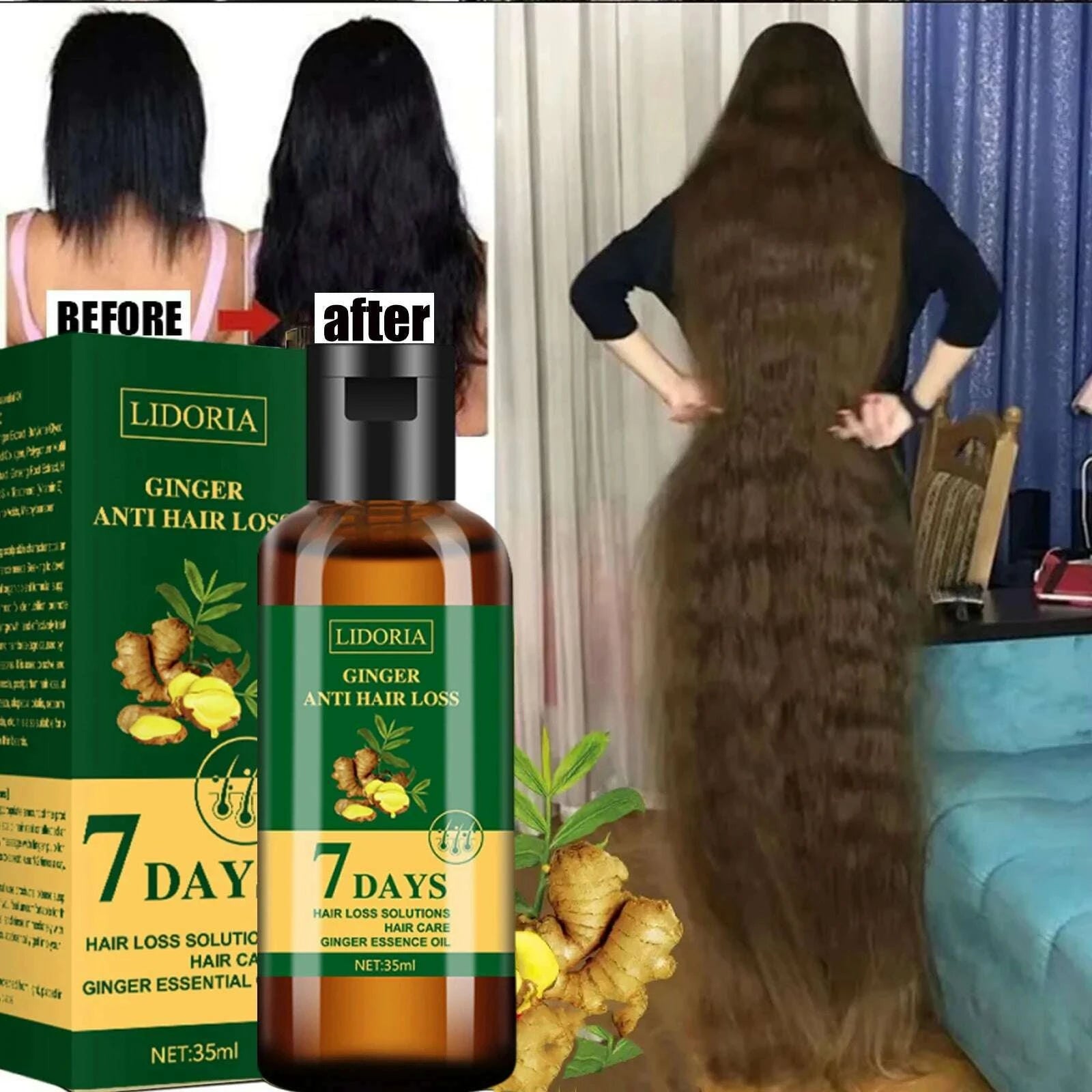 hair-growth-serum-7-days-fast-regrowth-essential-capsule-anti-hair-loss-baldness-repair-damaged-scalp-treatment-for-women-menkimlud-womens-fashion-34619624