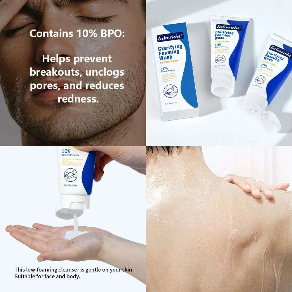 acne-foaming-wash-benzoyl-peroxide-10-maximum-antimicrobia-moisturizers-reduces-redness-for-face-body-skin-care-face-washkimlud-womens-fashion-34601554