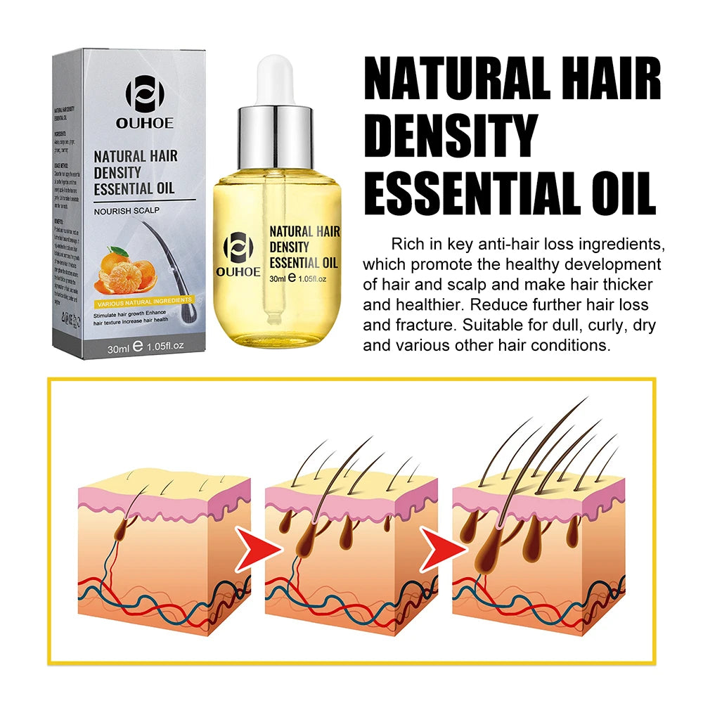 Ginger-Infused Hair Growth Oil Gift Set Ginger Essence — Golden | KIMLUD