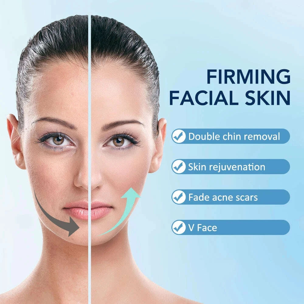 ems-face-lifting-machine-microcurrent-double-chin-remover-12-gears-facial-massager-vibration-slimming-firming-v-face-lift-devicekimludkimlud-35569312