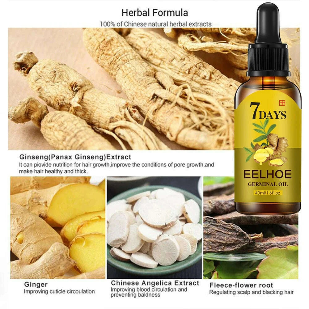 hair-growth-serum-fast-growing-hair-essential-oil-beauty-hair-care-102040ml-dense-regrowth-ginger-hair-promoting-regenerationkimlud-womens-fashion-34619648