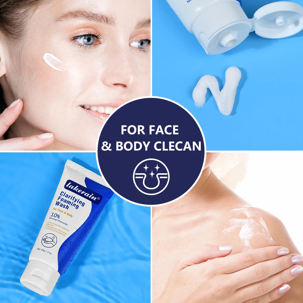 Acne Foaming Wash Benzoyl Peroxide 10% Maximum Antimicrobia Moisturizers reduces redness For Face & Body Skin Care Face Wash