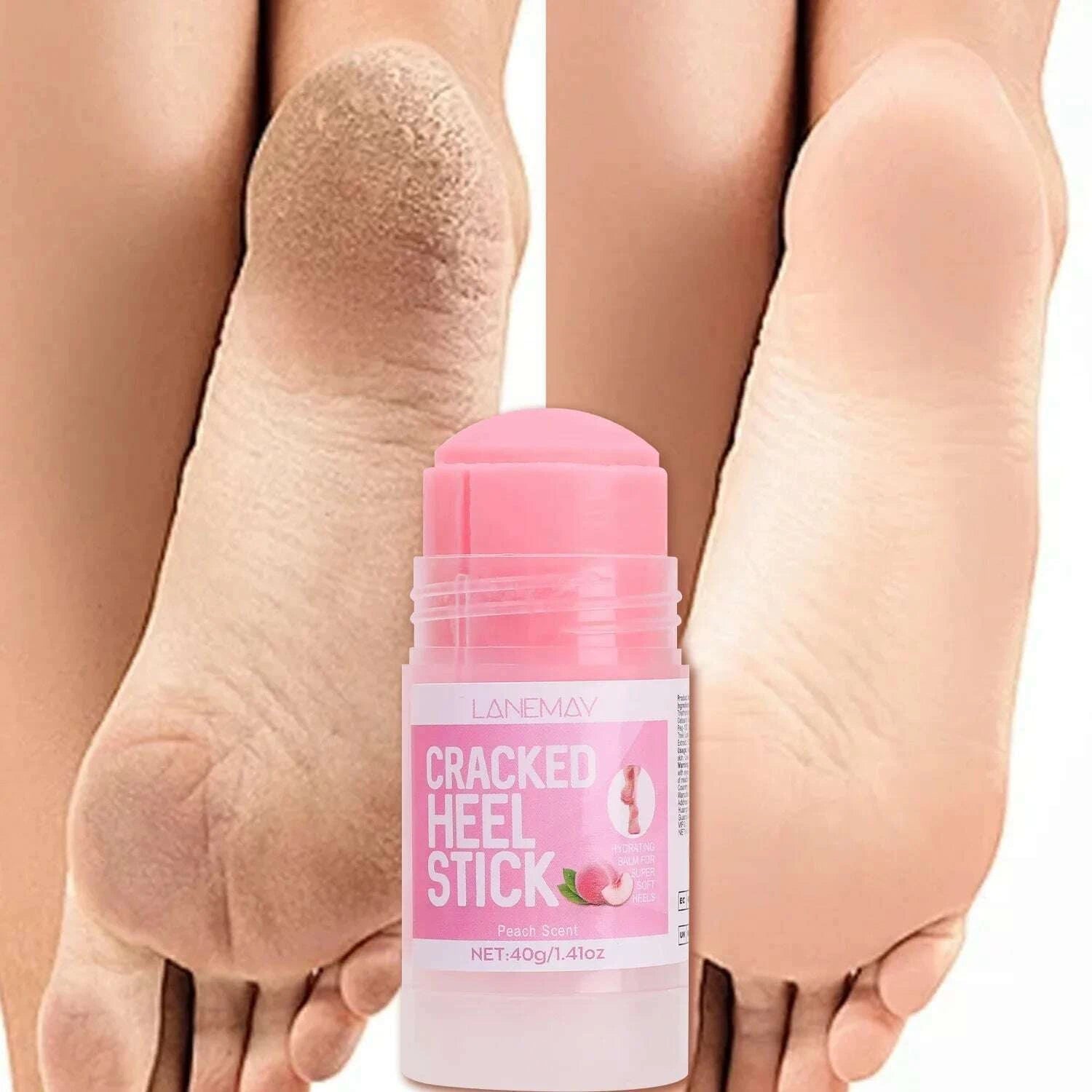 40g-ultra-hydrating-foot-cream-softening-dry-cracked-feet-daily-foot-care-solution-feet-cream-stick-repairing-moisturizing-toolkimlud-womens-fashion-34599404