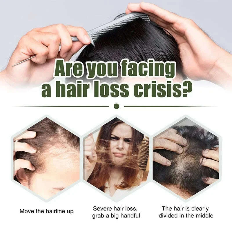 hair-growth-oil-africa-crazy-traction-alopecia-serum-anti-hair-break-thicken-hair-loss-treatment-spray-for-man-women-60mlkimlud-womens-fashion-34619638