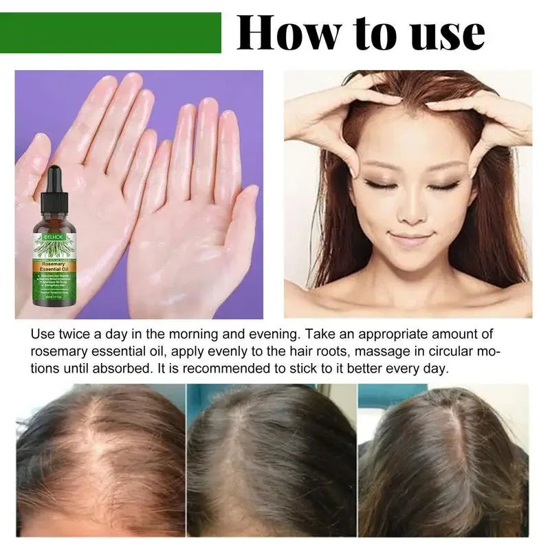 Rosemary Essential Oil Hair Growth Oil Nourishes Scalp For Healthy Shine — Green | KIMLUD