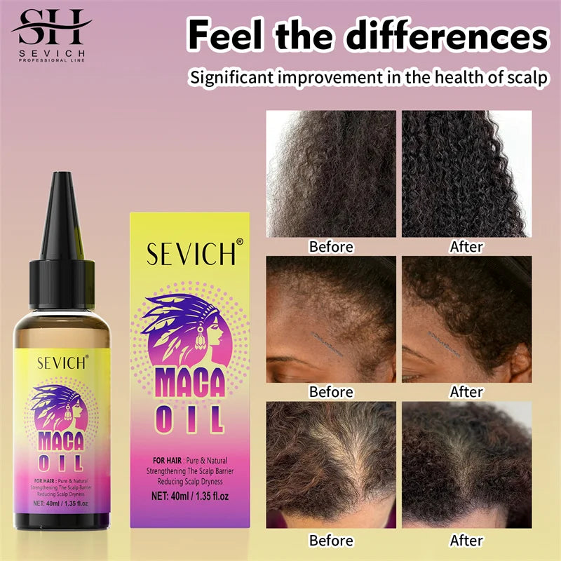 Maca Hair Growth Oil Set With Castor Oil — Sunny Yellow | KIMLUD