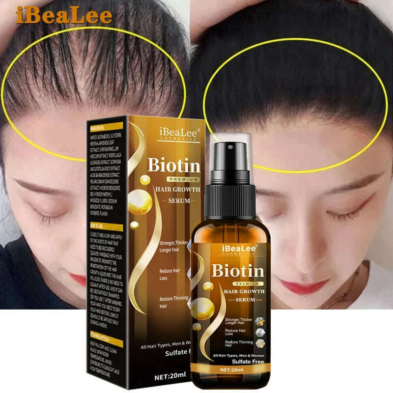 KIMLUD, Anti Hair Loss Serum Fast Hair Growth Spray Products Prevent Baldness Treatment Scalp Dry Damaged Beard Hair Care Essential Oils, KIMLUD Womens Clothes