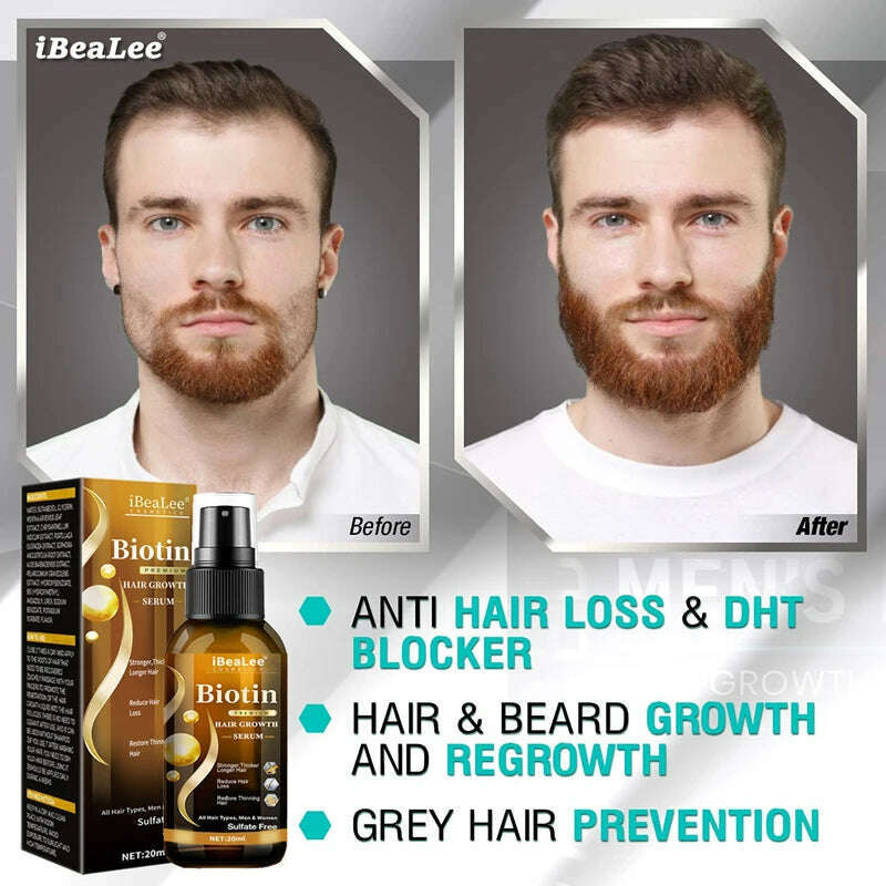 KIMLUD, Anti Hair Loss Serum Fast Hair Growth Spray Products Prevent Baldness Treatment Scalp Dry Damaged Beard Hair Care Essential Oils, KIMLUD Womens Clothes