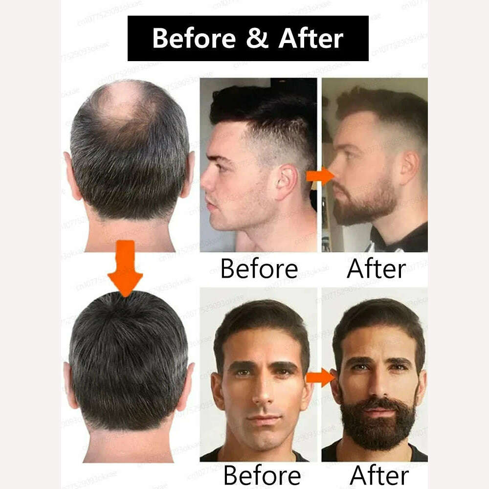 KIMLUD, Beard Growth Serum quickly thickens and softens beards for longer, fuller beards, KIMLUD Womens Clothes