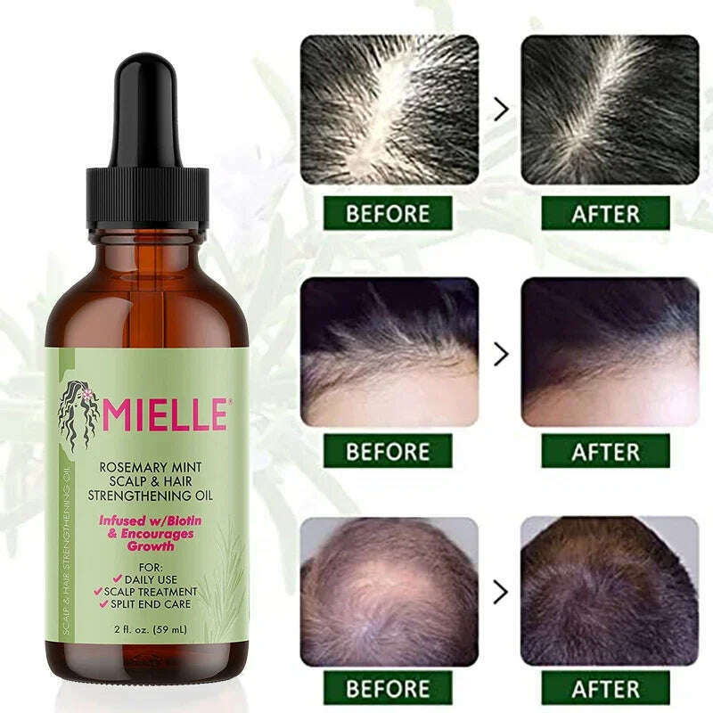 KIMLUD, Hair Growth Essential Oil Rosemary Mint Hair Strengthening Oil Treatment Dry Mielle Organics Split Ends Hair Essential Oil, KIMLUD Womens Clothes