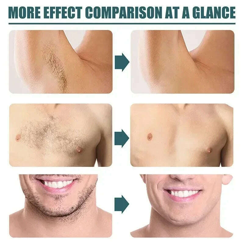 KIMLUD, Men Hair Remover Cream Inhibition Hair Growth Eliminate Beard Armpit Chest Private Parts Gently Depilatory Painless Remover, KIMLUD Womens Clothes