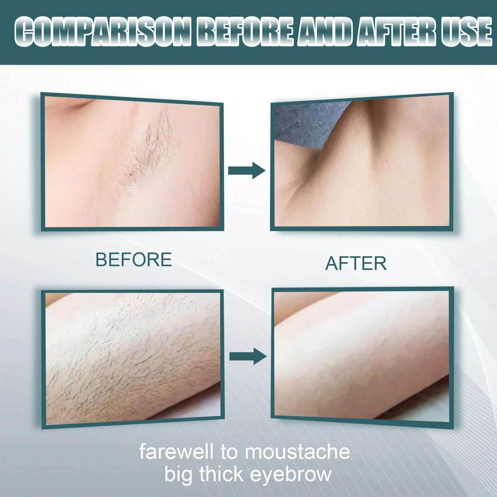 KIMLUD, Men Hair Remover Cream Inhibition Hair Growth Eliminate Beard Armpit Chest Private Parts Gently Depilatory Painless Remover, KIMLUD Womens Clothes
