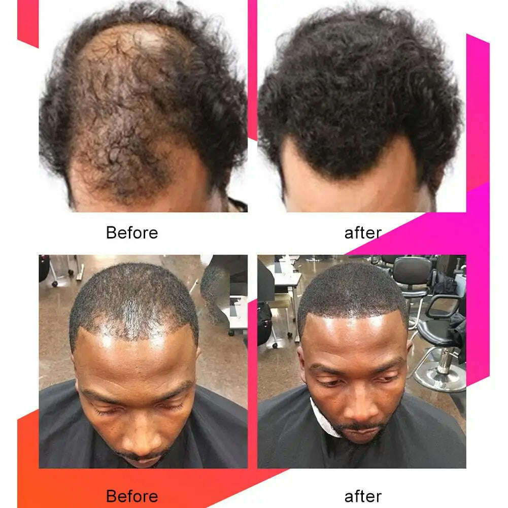 KIMLUD, New 100g Chebe Powder Africa Women Traction Alopecia Treatment Loss Men Of Spray Get Oil Rid Wig Hair Treatment V8E5, KIMLUD Womens Clothes