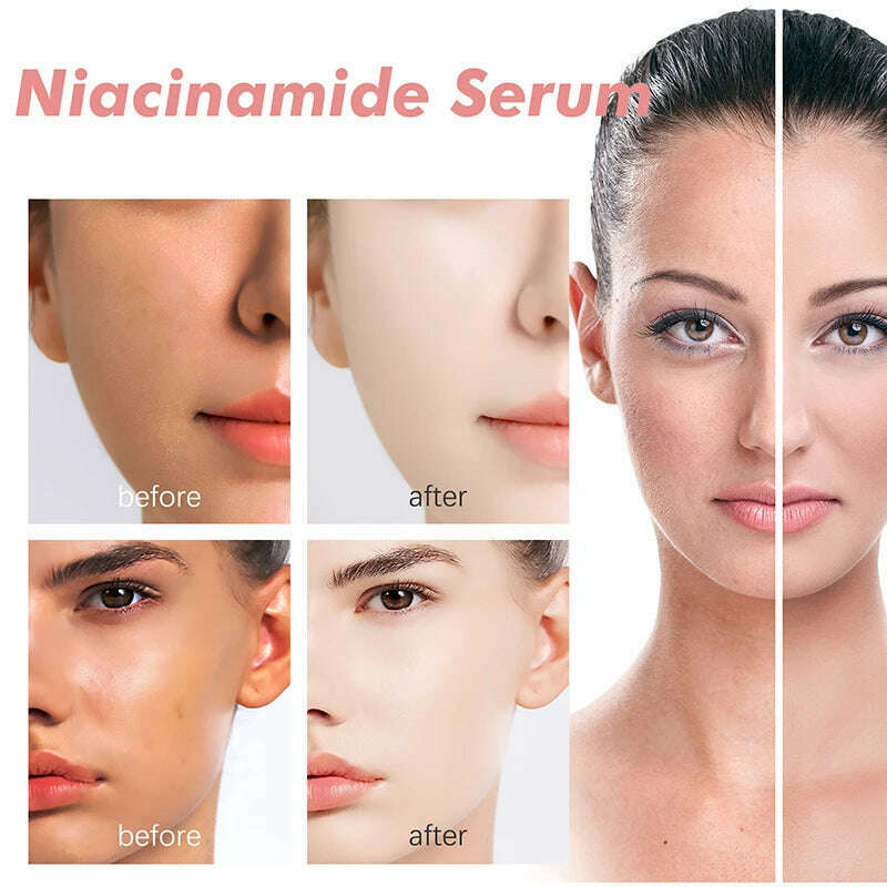 Peach 70% Niacinamide Serum 30ml Moisturizing Prevent Dryness Facial Essential Oil Increasing Elasticity Smooth Soften Skin Care - KIMLUD