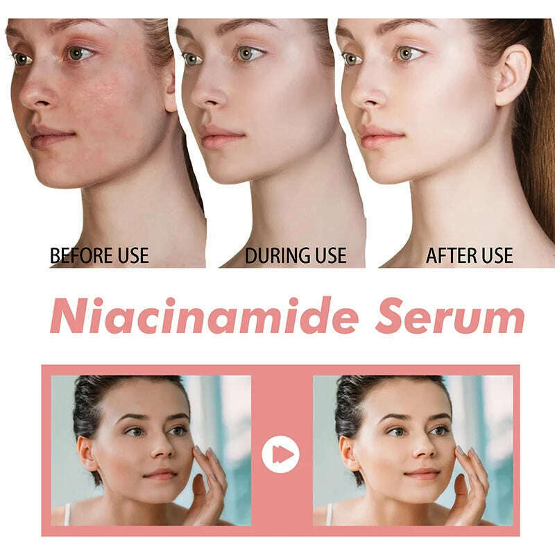 Peach 70% Niacinamide Serum 30ml Moisturizing Prevent Dryness Facial Essential Oil Increasing Elasticity Smooth Soften Skin Care - KIMLUD