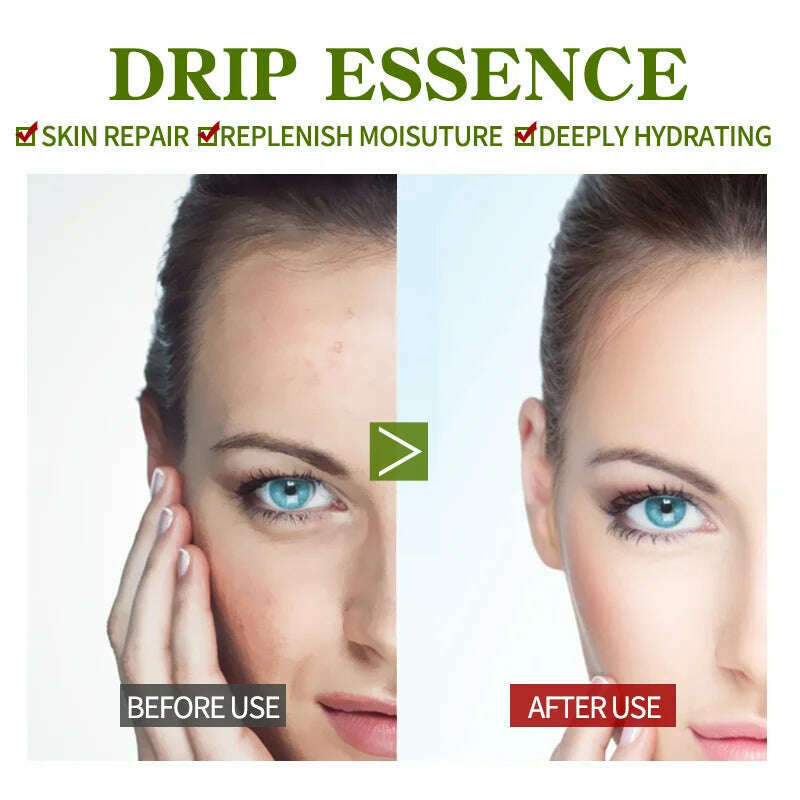 Vitamin B5 Face Serum Smooth Moisturizing Repair Dry Skin Aloe Soothe Pores Shrink Firming Hydrating Oil Control Facial Essence - KIMLUD