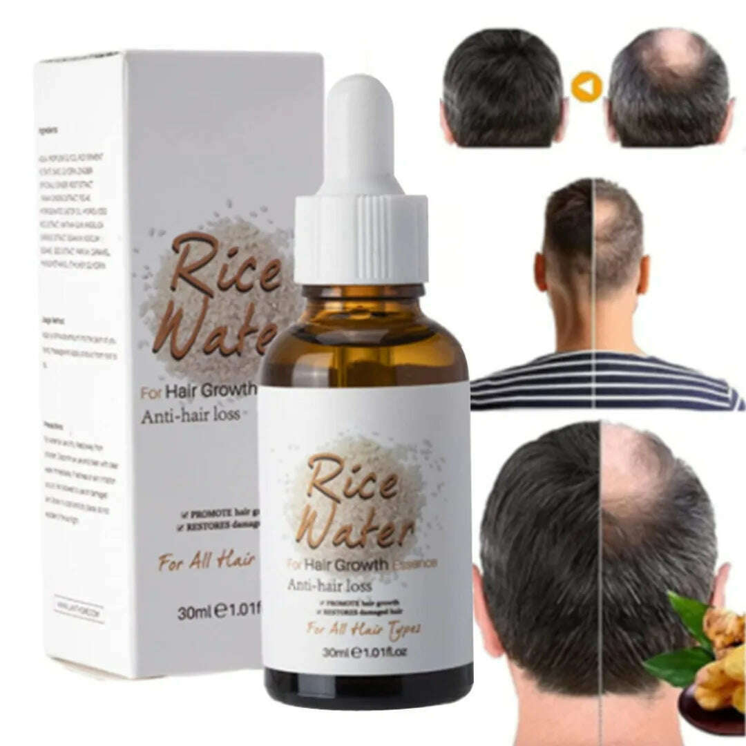 KIMLUD, 1 Pc 30ml Fermented Rice Water Hair Growth Serum Moisturize Hair Smooth for Thinning Hair Reduce Hair Loss Hair Care Beauty, KIMLUD Women's Clothes