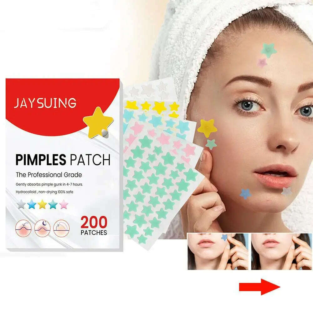 KIMLUD, 200pcs Star Pimple Patch Acne Colorful Invisible Acne Removal Skin Care Stickers  Face Spot Beauty Makeup Tool, KIMLUD Women's Clothes