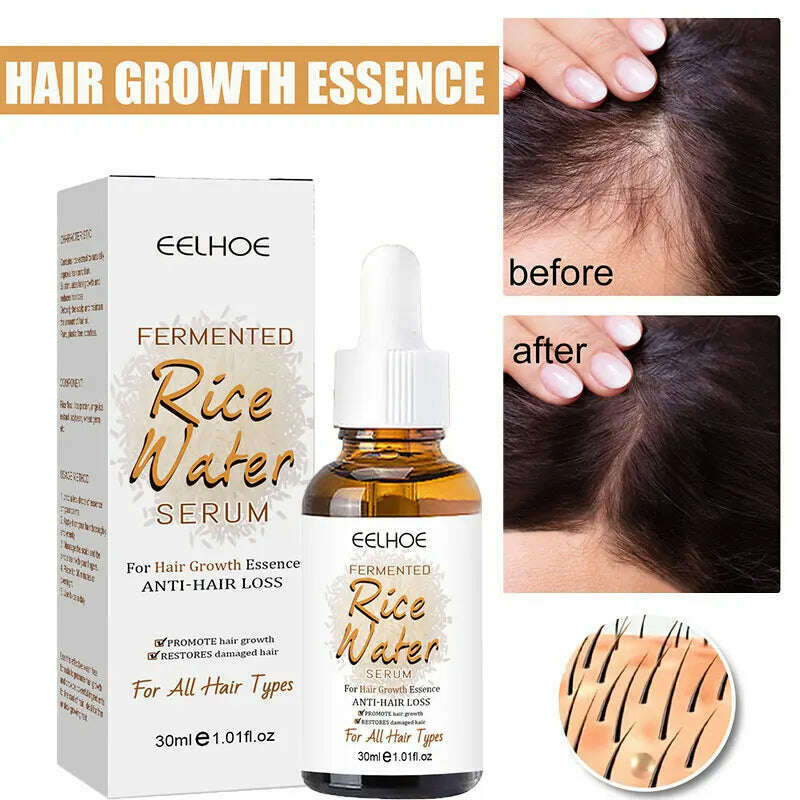 KIMLUD, 30ml Fermented Rice Water Serum Anti Hair Loss Stronger Healthier Hair Growing Essence Thicker Thinning Hair Growth Product, KIMLUD Women's Clothes