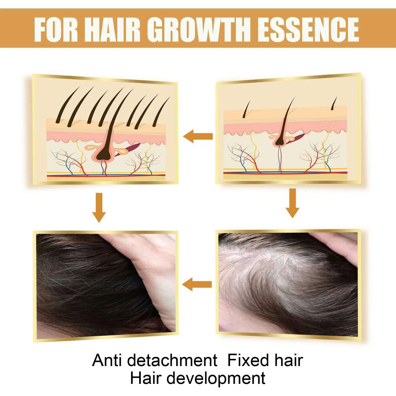 KIMLUD, 30ml Fermented Rice Water Serum Anti Hair Loss Stronger Healthier Hair Growing Essence Thicker Thinning Hair Growth Product, KIMLUD Womens Clothes