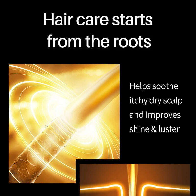 KIMLUD, 50ml Black Rice Water Hair Spray Hair Growth Essence Anti Hair Loss Natural Thinning Anti Hair Loss Soothe Itchy Dry Scalp Care, KIMLUD Womens Clothes