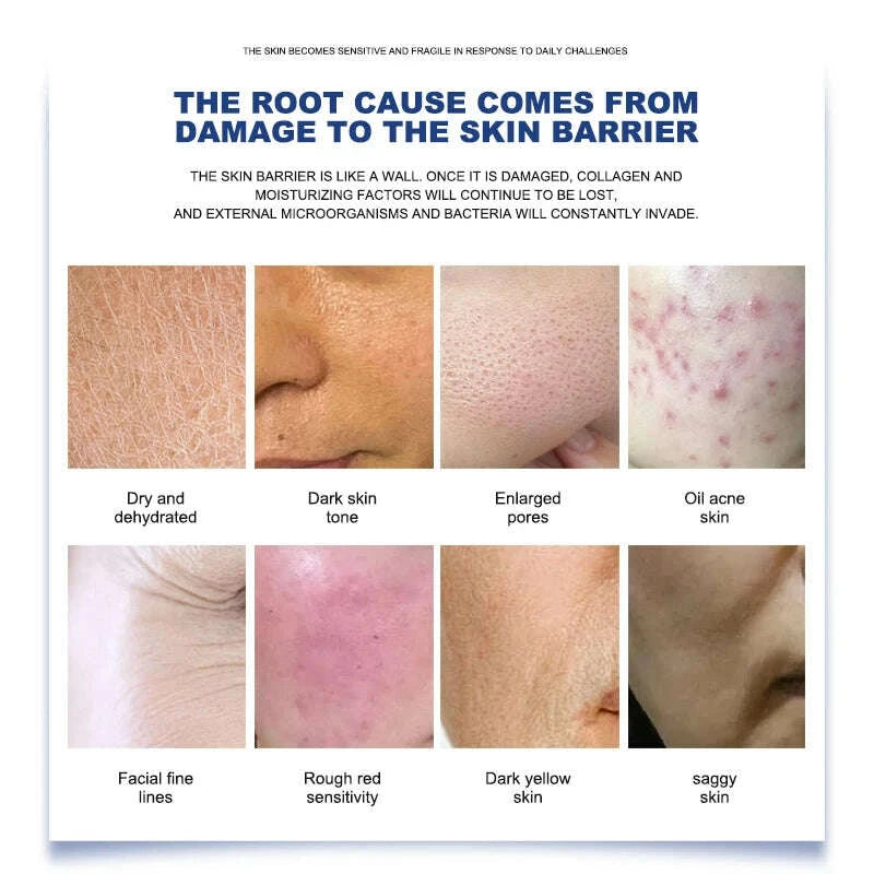 kimlud-newest-hydration-brightening-beauty-machine-for-home-use-facial-care-equipment-with-oxygen-jet-peel-and-firming-dermabrasion-kimlud-womens-clothes-35044774