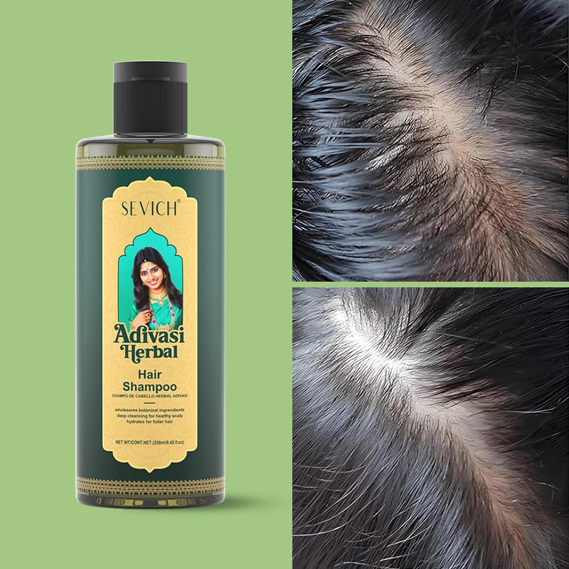 Ayurvedic Herbal Hair Growth Oil Set — Emerald | KIMLUD